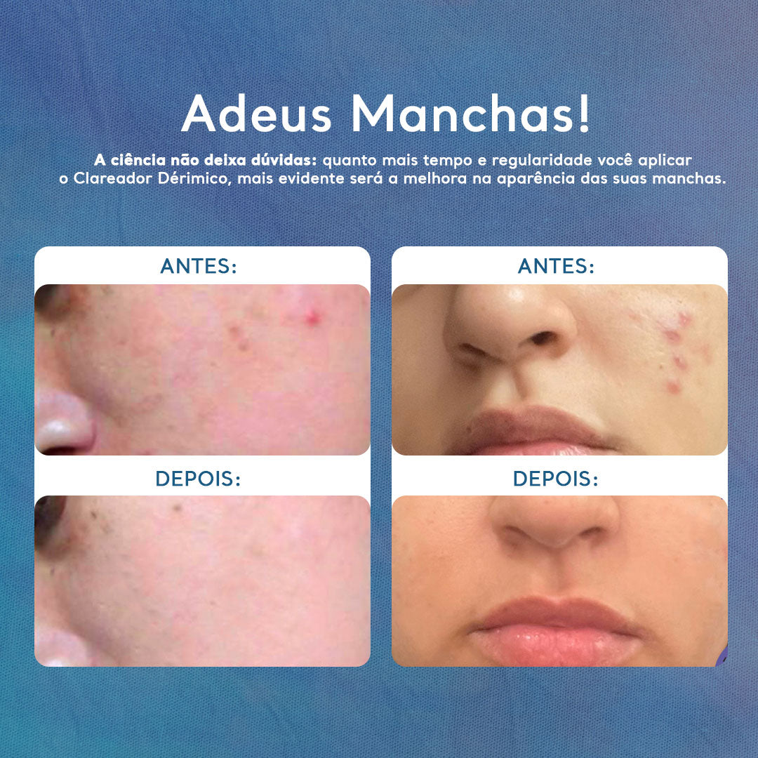 Kit Xô Celulites e Manchas