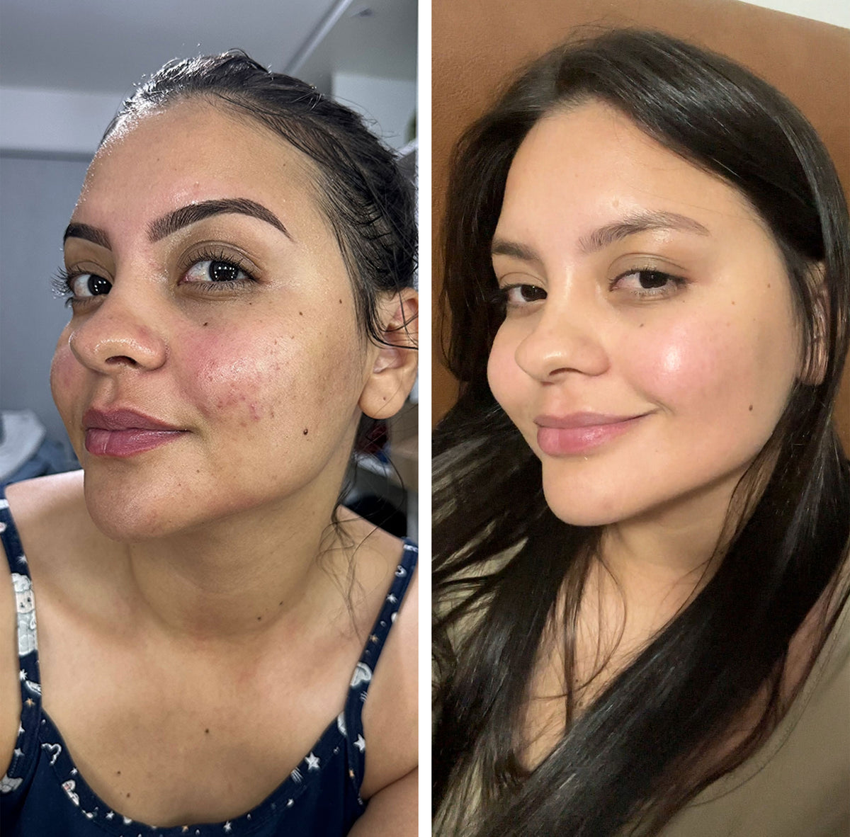 Before and after skin appearance