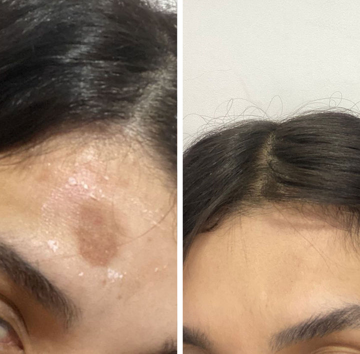 Antes e depois