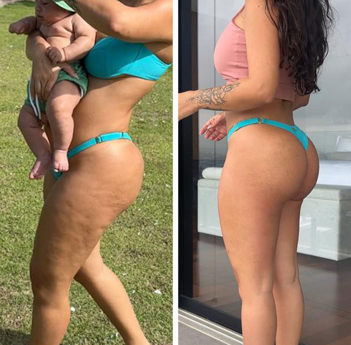 Antes e depois