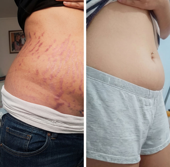Antes e depois