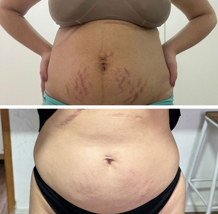 Antes e depois