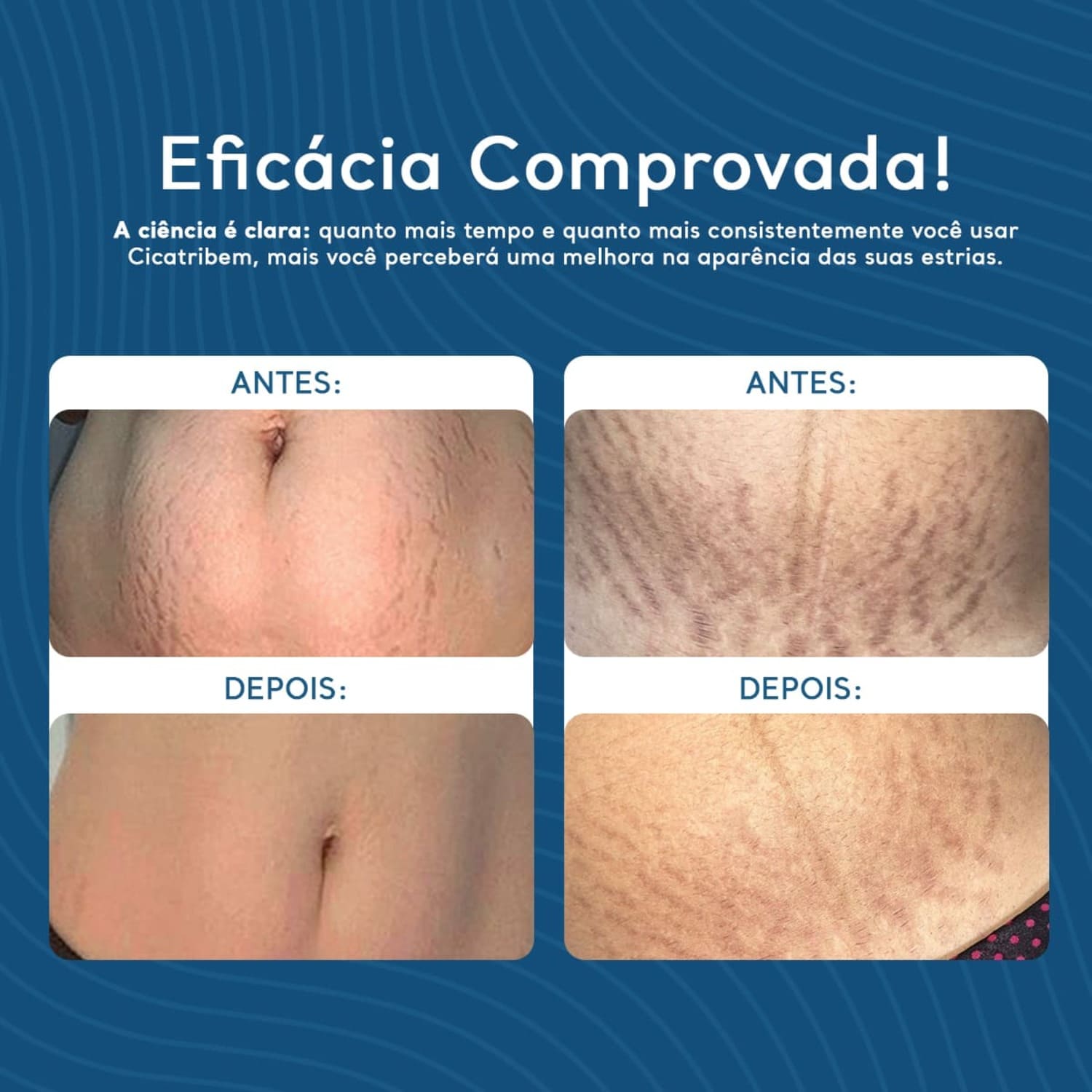 Creme Antiestrias Regenerador Dérmico 2 Unidades